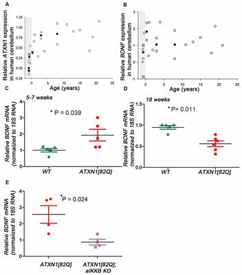 Brain Derived Neurotrophic Factor (BDNF) Delays Onset of Pathogenesis in Transgenic Mouse Model of Spinocerebellar Ataxia Type 1 (SCA1)